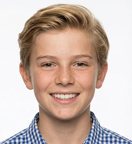 Early Interceptive Orthodontics 1 after