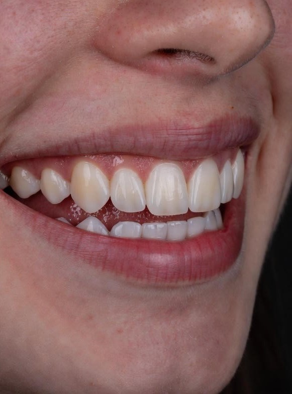 cosmetic_dentistry11