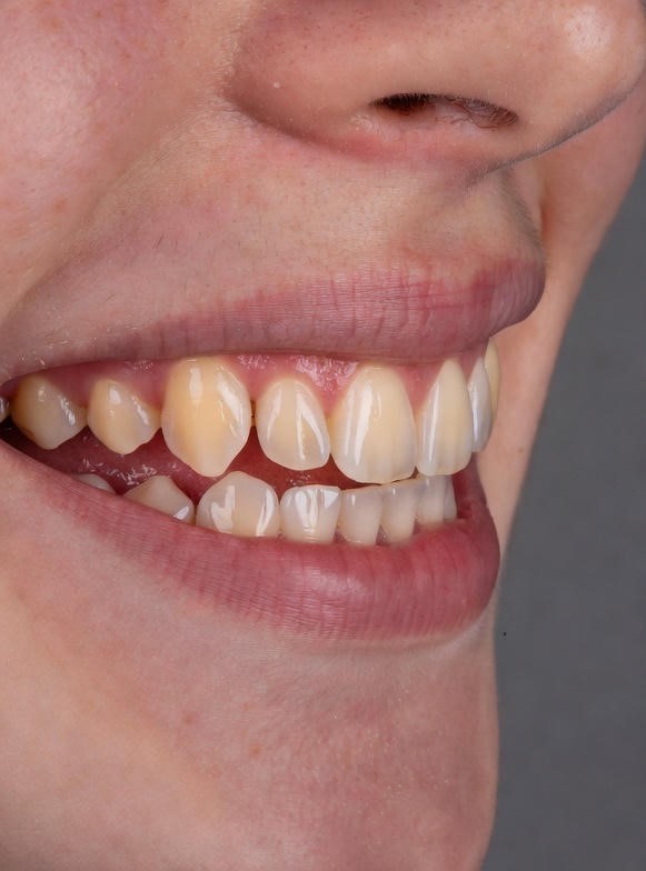 cosmetic_dentistry12