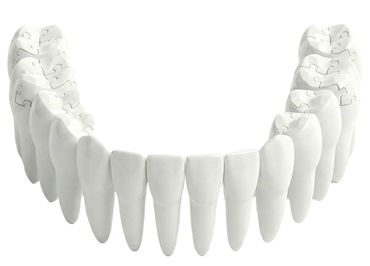 full-mouth-rehabilitation