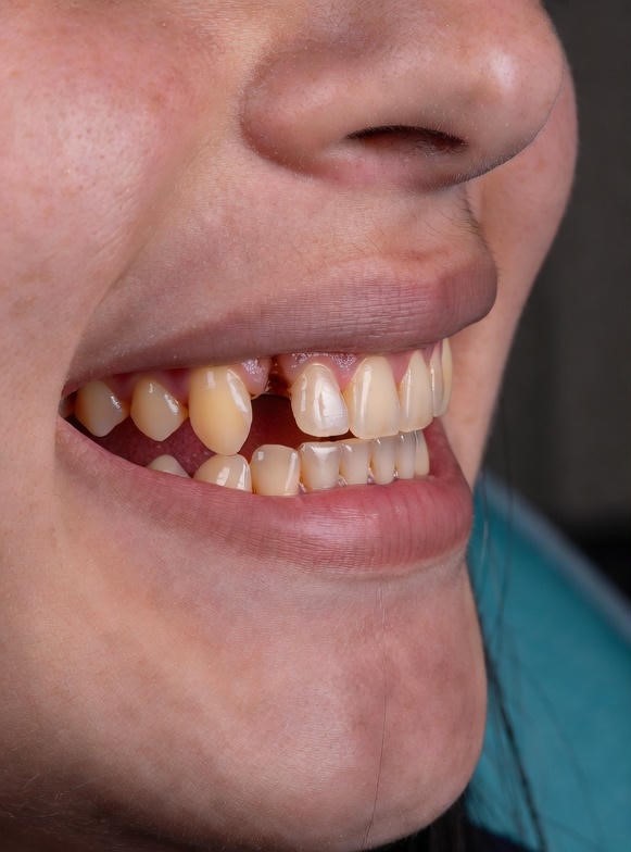 restorative-dentistry11