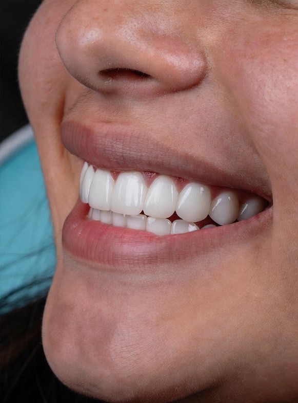 restorative-dentistry12