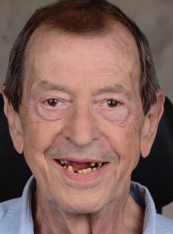 restorative-dentistry_21