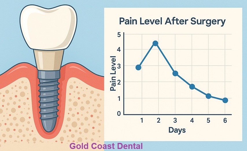 Dental_Implant_Pain_Scale