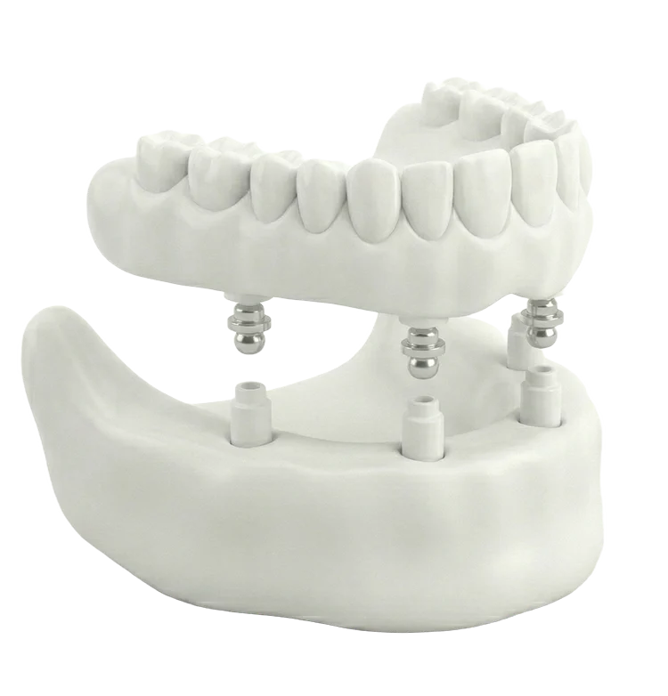 Snap‑In Denture Icon