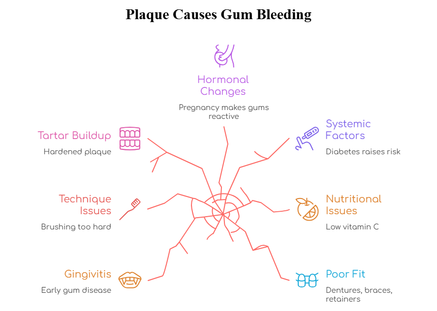 Infograph: why are my gums bleeding when I brush my teeth