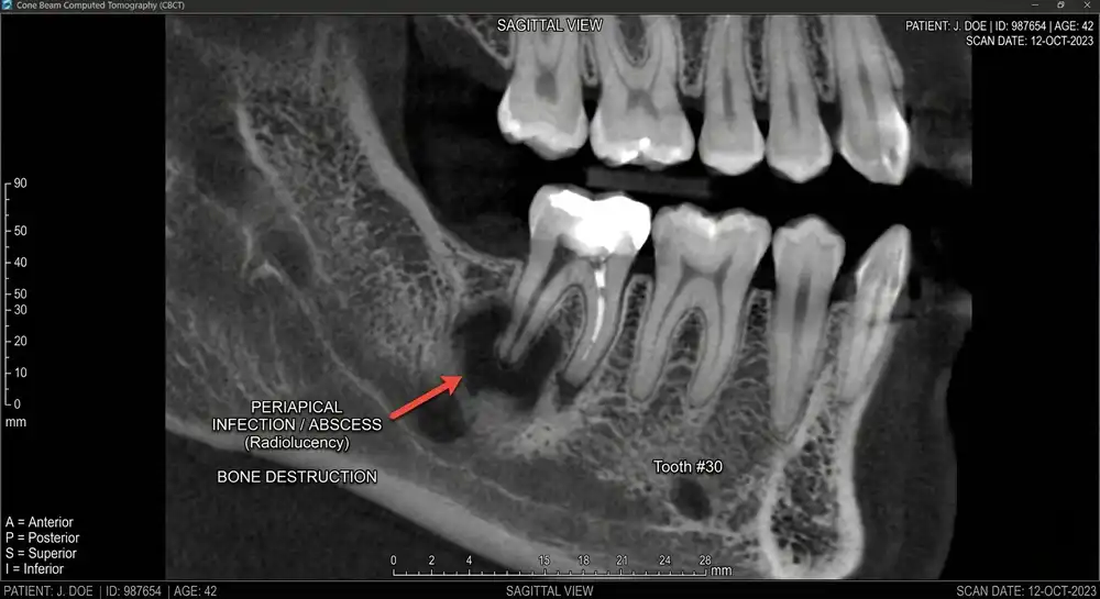 True Dental Emergency vs. What Can Wait | Artesia, CA Dentist