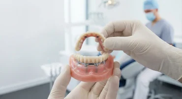 Fixed-Hybrid-Denture-Gold-Coast-Dental