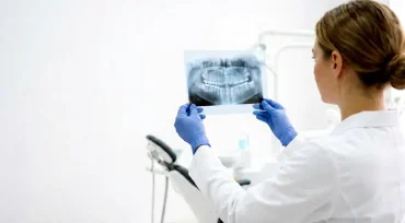 Gold coast dental Wisdom Teeth removal