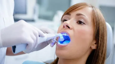 dental fillings Gold Coast Dental