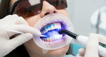 teeth-whitening Gold Coast Dental
